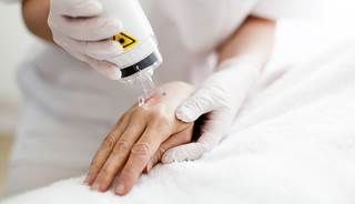 Laser therapy plus topical effective for generalized plaque psoriasis Laser therapy plus topical effective for generalized plaque psoriasis