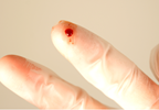 Needlestick accidents at work: What to do next Needlestick accidents at work: What to do next