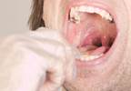 Double-check a strep test Double-check a strep test