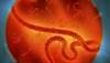 When to suspect Ebola When to suspect Ebola