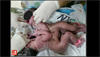 Image of the Week: Conjoined twins Image of the Week: Conjoined twins