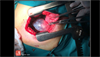 Image of the Week: Bullous emphysema Image of the Week: Bullous emphysema