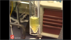 Image of the Week: Yellow cerebral spinal fluid Image of the Week: Yellow cerebral spinal fluid
