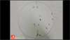 Image of the Week: Clock draw test Image of the Week: Clock draw test