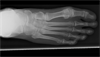 Ortho Dx: Foot pain for 10 years Ortho Dx: Foot pain for 10 years