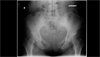 Ortho Dx: Low back, pelvic pain following childbirth Ortho Dx: Low back, pelvic pain following childbirth