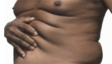 At least 4% weight loss needed to cut diabetes risk At least 4% weight loss needed to cut diabetes risk