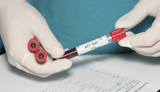 For HIV-negative people with HIV-positive partners, prevention with treatment reduces transmission. For HIV-negative people with HIV-positive partners, prevention with treatment reduces transmission.
