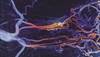 Treating hypertension—Losing sight of the forest for the trees? Treating hypertension—Losing sight of the forest for the trees?
