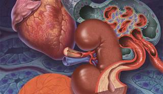 Diabetes can lead to CVD, kidney disease, and diabetic retinopathy. Diabetes can lead to CVD, kidney disease, and diabetic retinopathy.