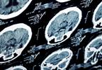 Insurer practices are subject of $10M malpractice suit Insurer practices are subject of $10M malpractice suit