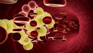 Too few US adults are taking necessary cholesterol-lowering medications. Too few US adults are taking necessary cholesterol-lowering medications.