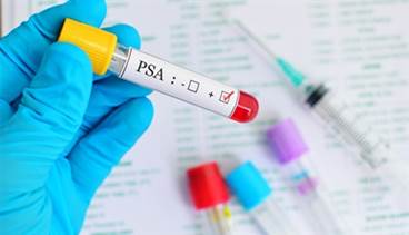 Diagnostic factors help patients avoid confirmatory prostate biopsy Diagnostic factors help patients avoid confirmatory prostate biopsy