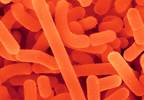 Lactobacillus acidophilus may effectively treat gastric infections, autoimmune conditions Lactobacillus acidophilus may effectively treat gastric infections, autoimmune conditions
