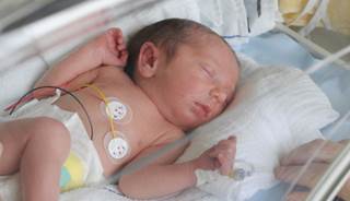 Steroids for premature babies 34 weeks