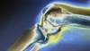 Osteoarthritis: conservative treatment options Osteoarthritis: conservative treatment options