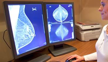 digital mammography and tomosynthesis for breast cancer diagnosis Mammogram: a mammogram is an x-ray exam of the breast a special some breast cancers do not show up on mammograms or “hide” in dense breast tissue mammograms and tomosynthesis exams can be recorded digitally and stored . digital mammography and tomosynthesis for breast cancer diagnosis Mammogram: a mammogram is an x-ray exam of the breast a special some breast cancers do not show up on mammograms or “hide” in dense breast tissue mammograms and tomosynthesis exams can be recorded digitally and stored .