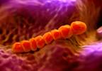 Blood eosinophil counts linked to adverse pneumonia events in COPD patients Blood eosinophil counts linked to adverse pneumonia events in COPD patients