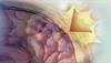 Managing concussion in primary care Managing concussion in primary care
