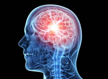 Sleep disturbances after traumatic brain injury Sleep disturbances after traumatic brain injury