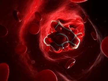 Comparing anticoagulants to prevent venous thromboembolism after hip and knee arthroplasty Comparing anticoagulants to prevent venous thromboembolism after hip and knee arthroplasty