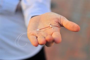 Pain during IUD insertion reduced with lidocaine nerve block Pain during IUD insertion reduced with lidocaine nerve block
