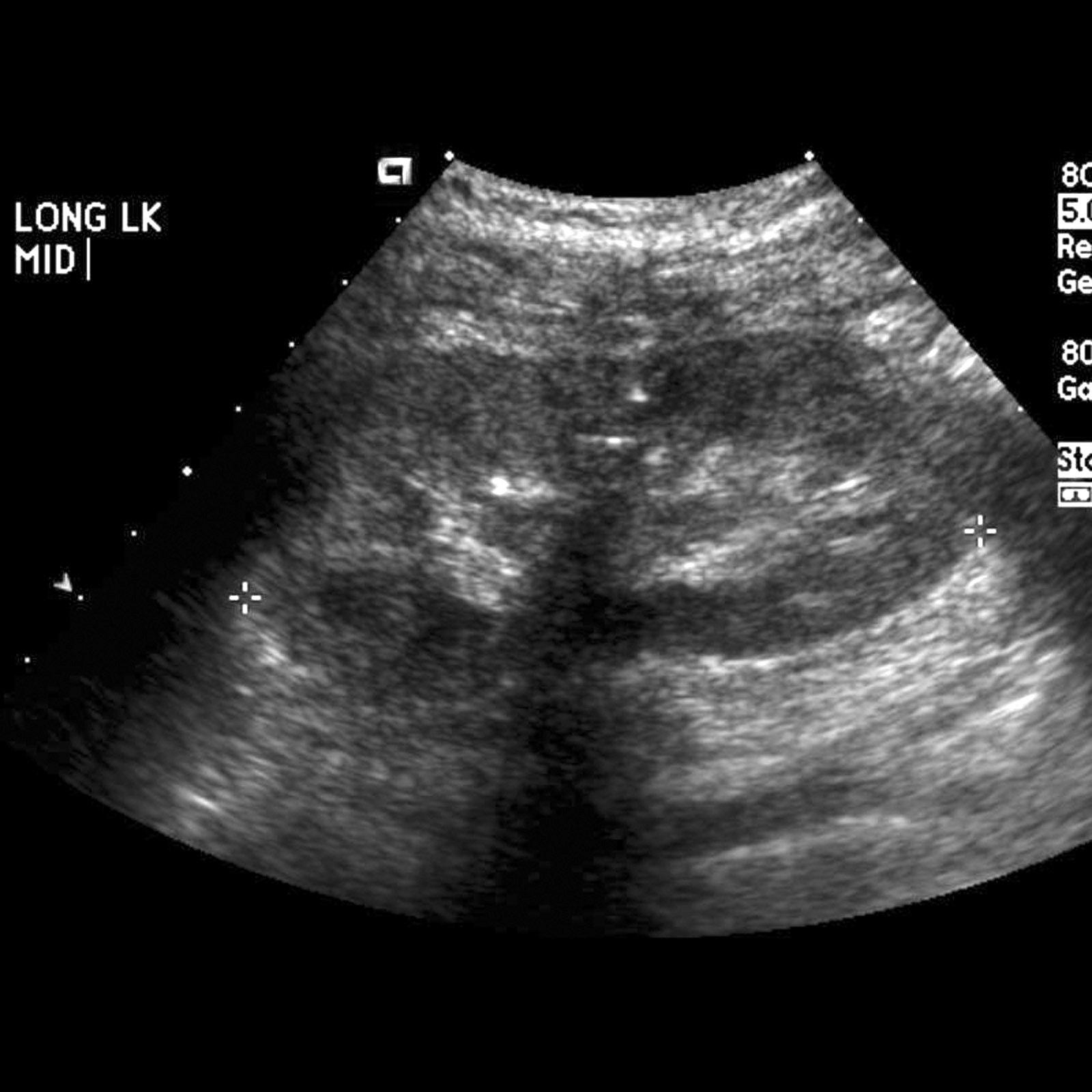 Renal Trauma - The Clinical Advisor