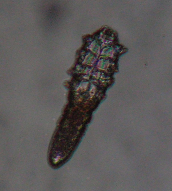 Demodicidosis (Other acariasis