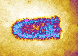 Rabies virus shown with its helical nucleocapsid Rabies virus shown with its helical nucleocapsid