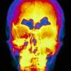 Treatment options for respiratory infections Treatment options for respiratory infections