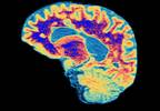 Comorbidities slow MS diagnosis Comorbidities slow MS diagnosis