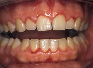 The links between oral and systemic health The links between oral and systemic health