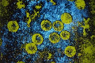 Transmission electron micrograph of hepatitis B virus cores (green) Transmission electron micrograph of hepatitis B virus cores (green)