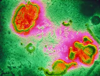 RSV particles (red/pink) may affect infants more severely than adults. RSV particles (red/pink) may affect infants more severely than adults.