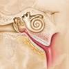 Chronic dysfunction of the eustachian tube Chronic dysfunction of the eustachian tube