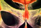 Recognizing symptoms of an enlarged prostate Recognizing symptoms of an enlarged prostate