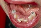 Health problems linked with state of the gums Health problems linked with state of the gums