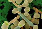 Candidiasis: New agents for invasive infections Candidiasis: New agents for invasive infections
