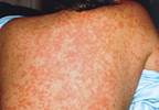 Factors influencing immunization rates Factors influencing immunization rates