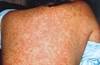Factors influencing immunization rates Factors influencing immunization rates