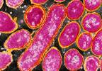 Immune System May Play Greater Role in Alzheimer's Than Thought Immune System May Play Greater Role in Alzheimer's Than Thought