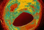 Lowering CVD risk among pediatric patients Lowering CVD risk among pediatric patients