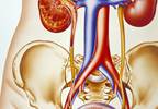 Managing UTIs in debilitated patients Managing UTIs in debilitated patients