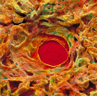 An ulcer forms when the barrier protecting the stomach lining is ineffective. An ulcer forms when the barrier protecting the stomach lining is ineffective.
