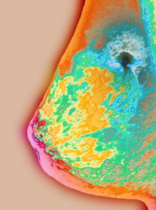 Colored x-ray of the breast reveals a malignant tumor (black). Colored x-ray of the breast reveals a malignant tumor (black).