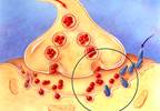 New drug options for dementia and Parkinson's disease New drug options for dementia and Parkinson's disease