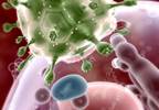 HIV: Make the diagnosis and take the next step HIV: Make the diagnosis and take the next step
