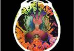 Alzheimers management from diagnosis to late stage Alzheimers management from diagnosis to late stage