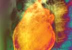 Chest pain: When should I be worried? Chest pain: When should I be worried?
