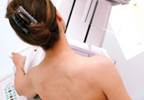 Red breast is a red flag in a case of new-onset pain and swelling Red breast is a red flag in a case of new-onset pain and swelling